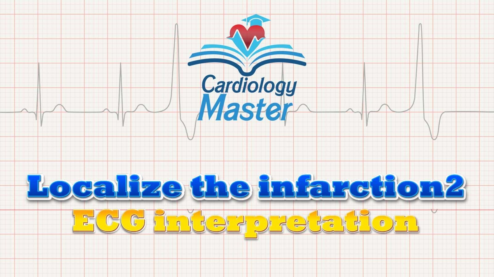 6. Localize the infarction 2, ECG interpretation