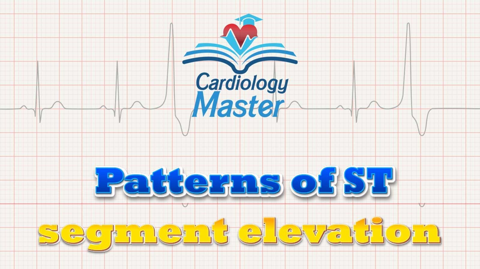4. ST segment elevation