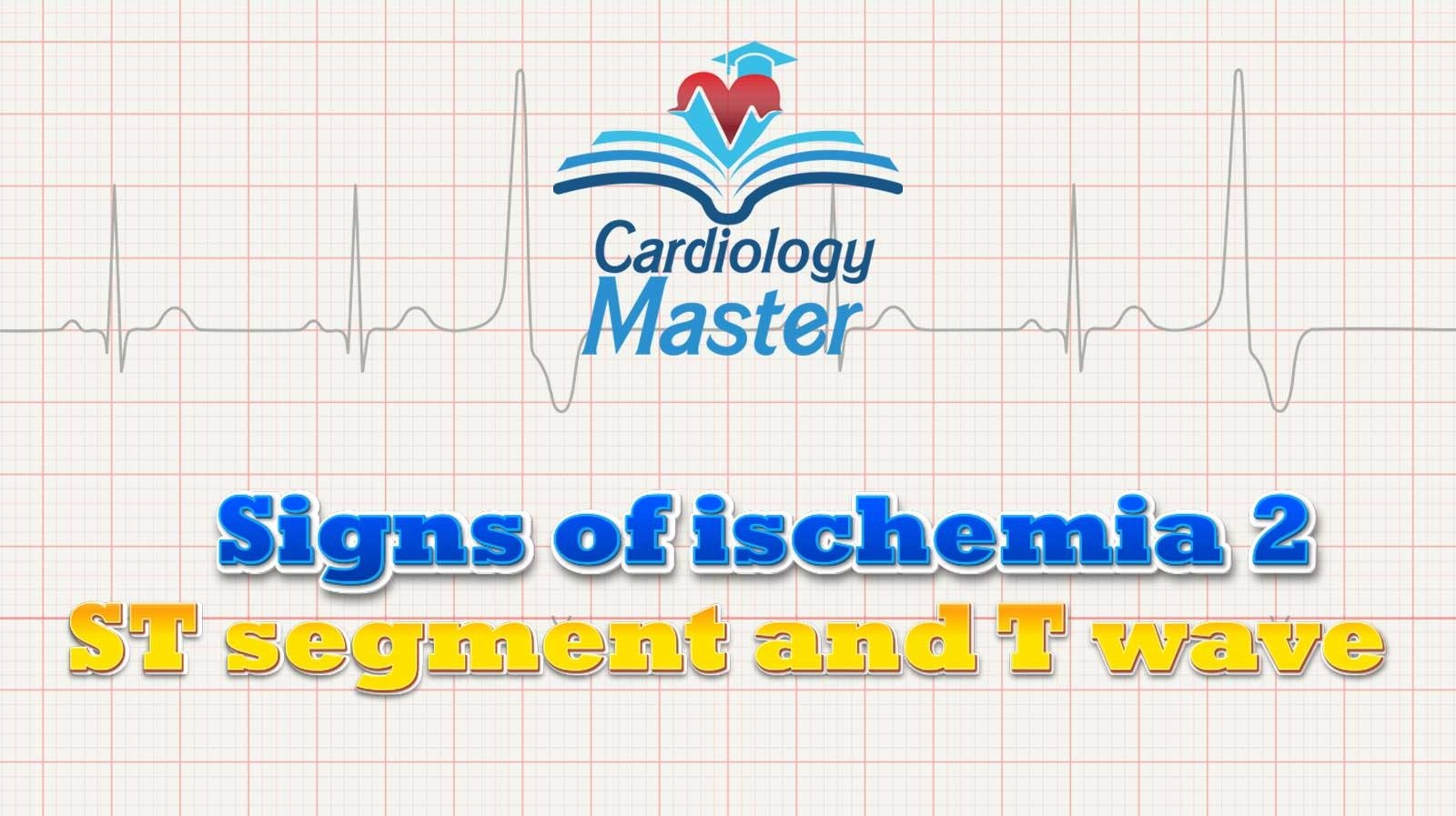3. Signs of ischemia 2, the ST segment changes