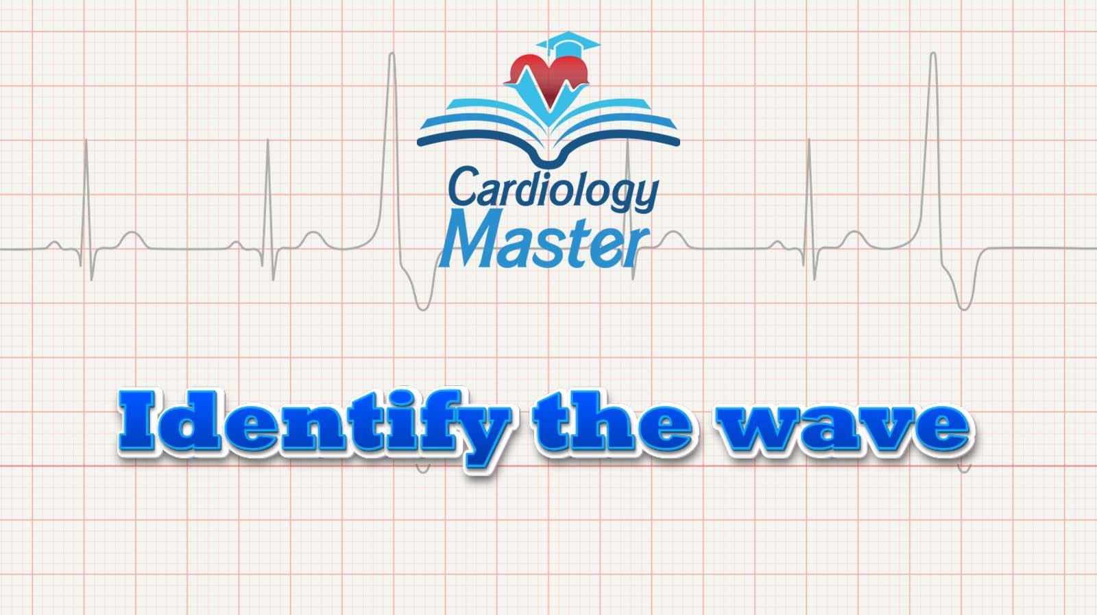 1. Identify the waves on the ECG