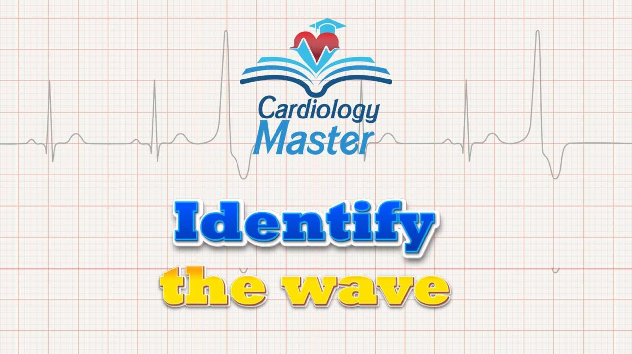1. Identify the waves on the ECG