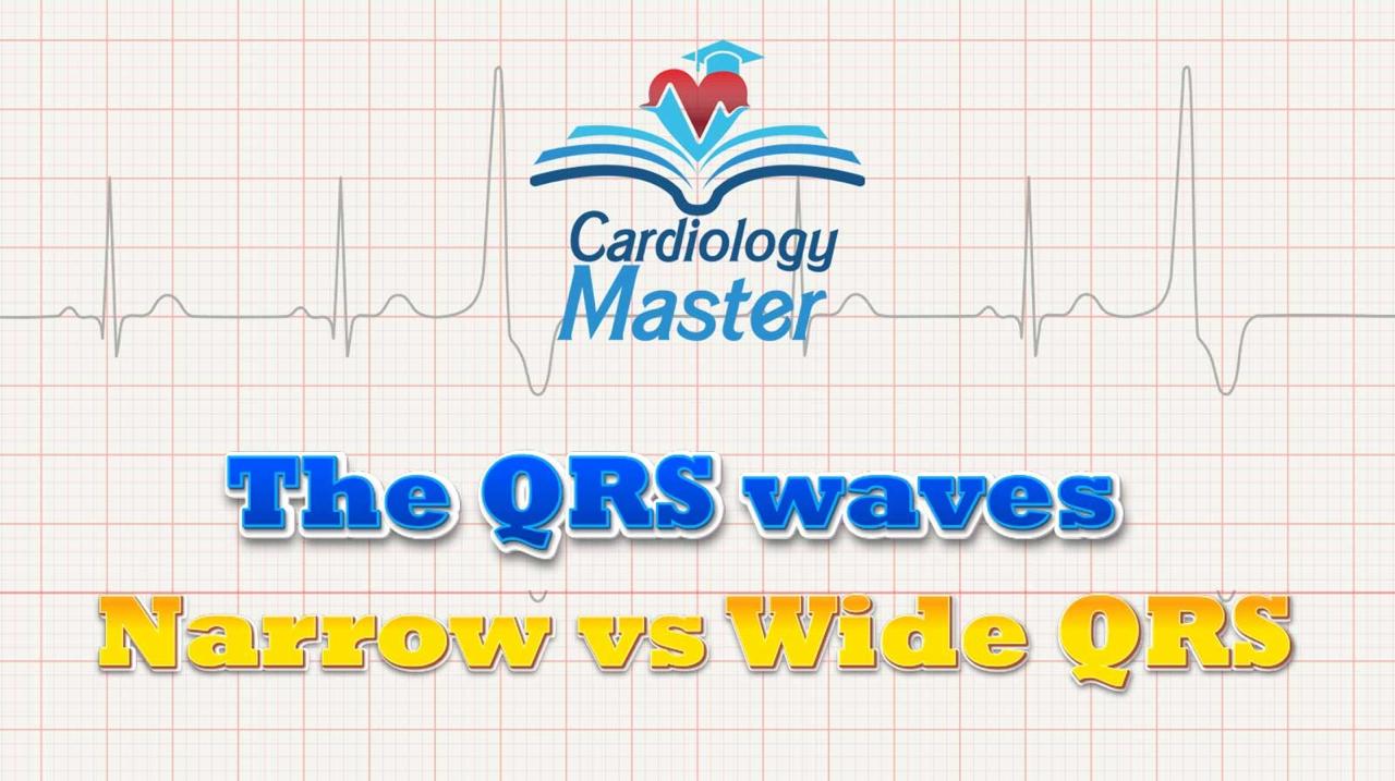 2. The QRS wave shapes, narrow vs wide QRS