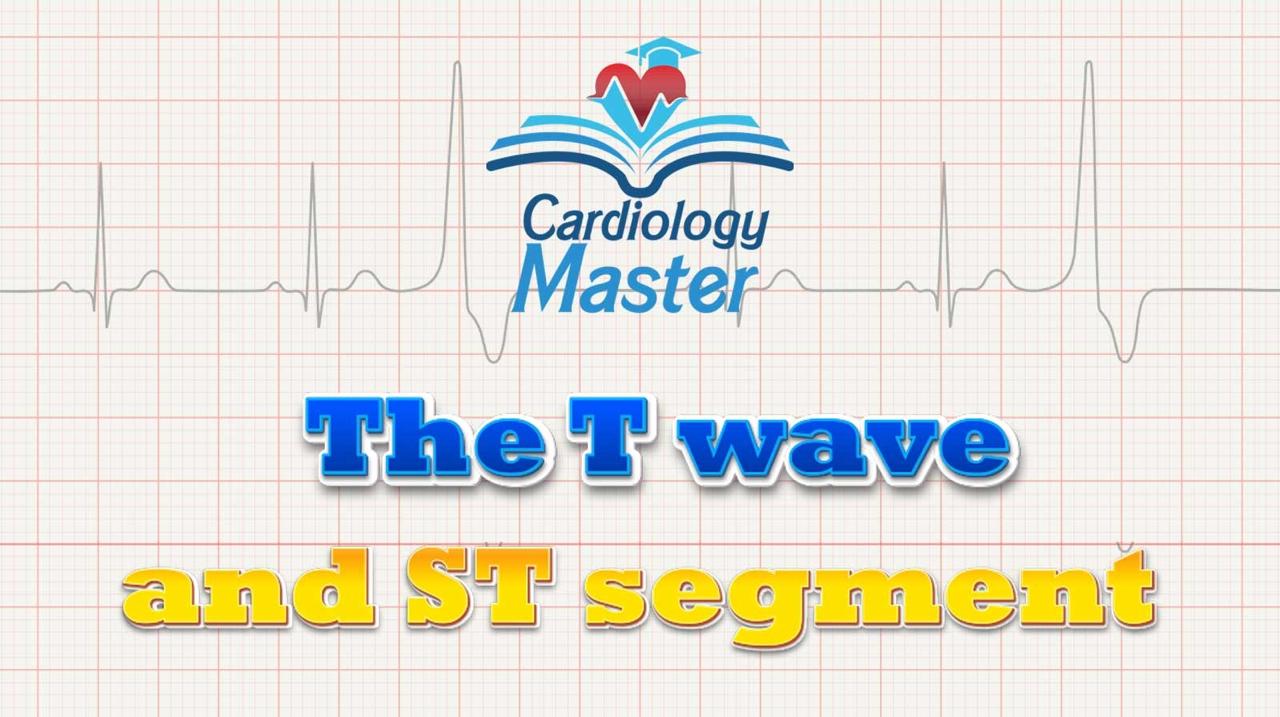 3. The T wave and the ST segment