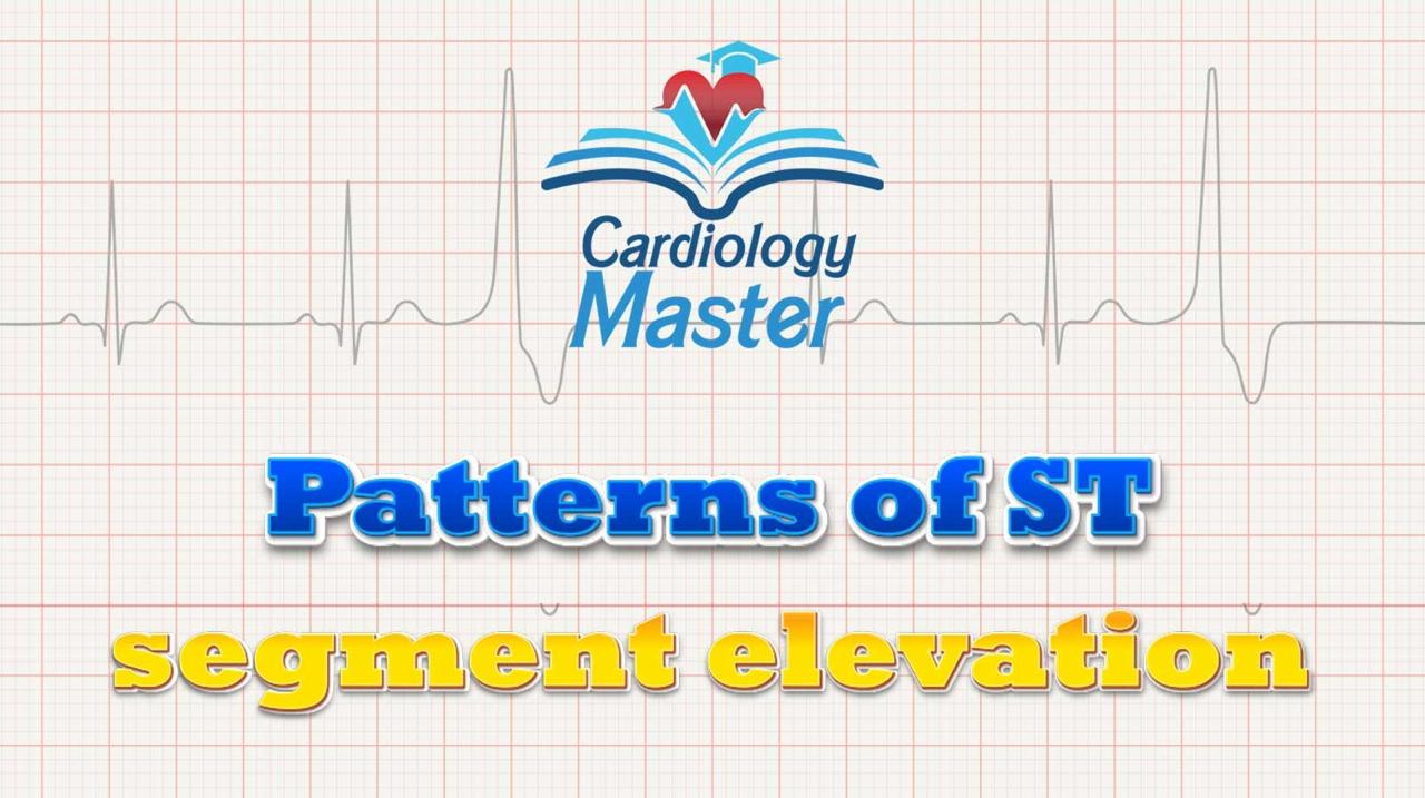 4. Patterns of ST elevation