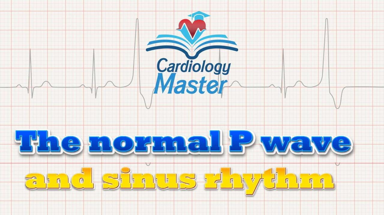 1. The normal P waves and sinus rhythm