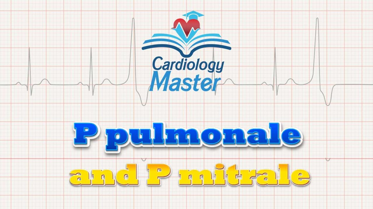 2. P pulmonale and P mitrale