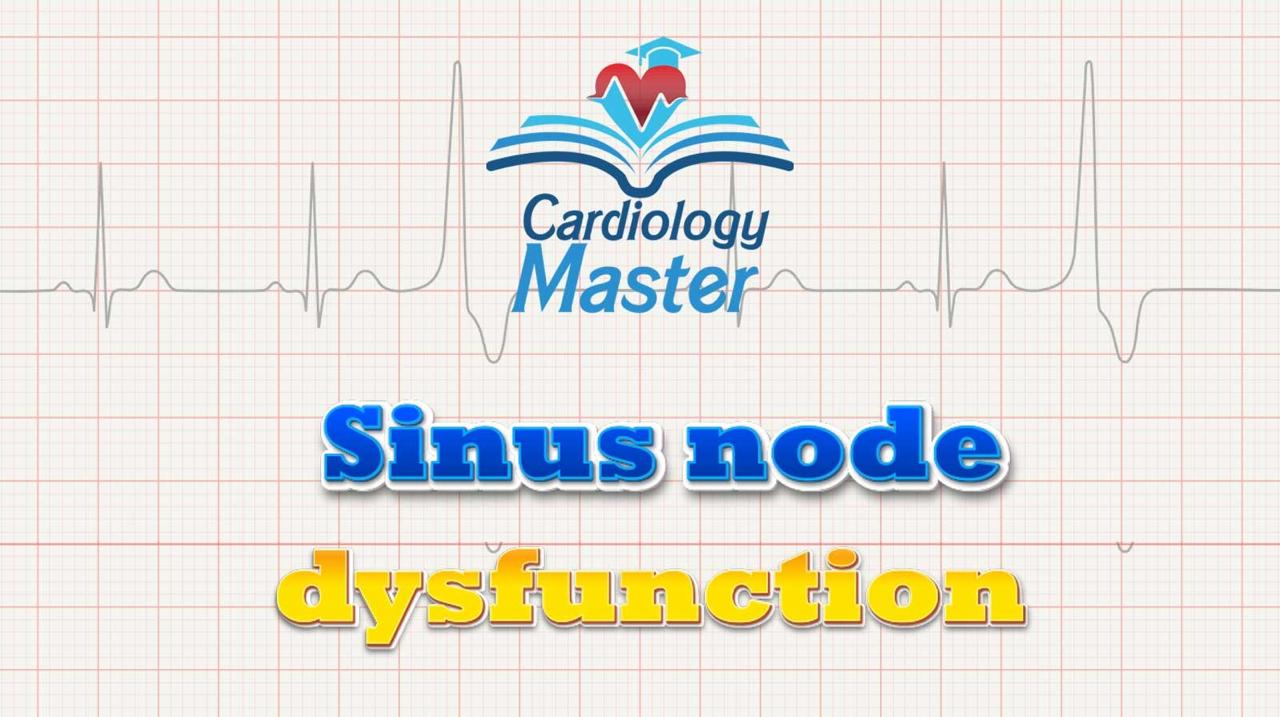 5. Sinus node dysfunction