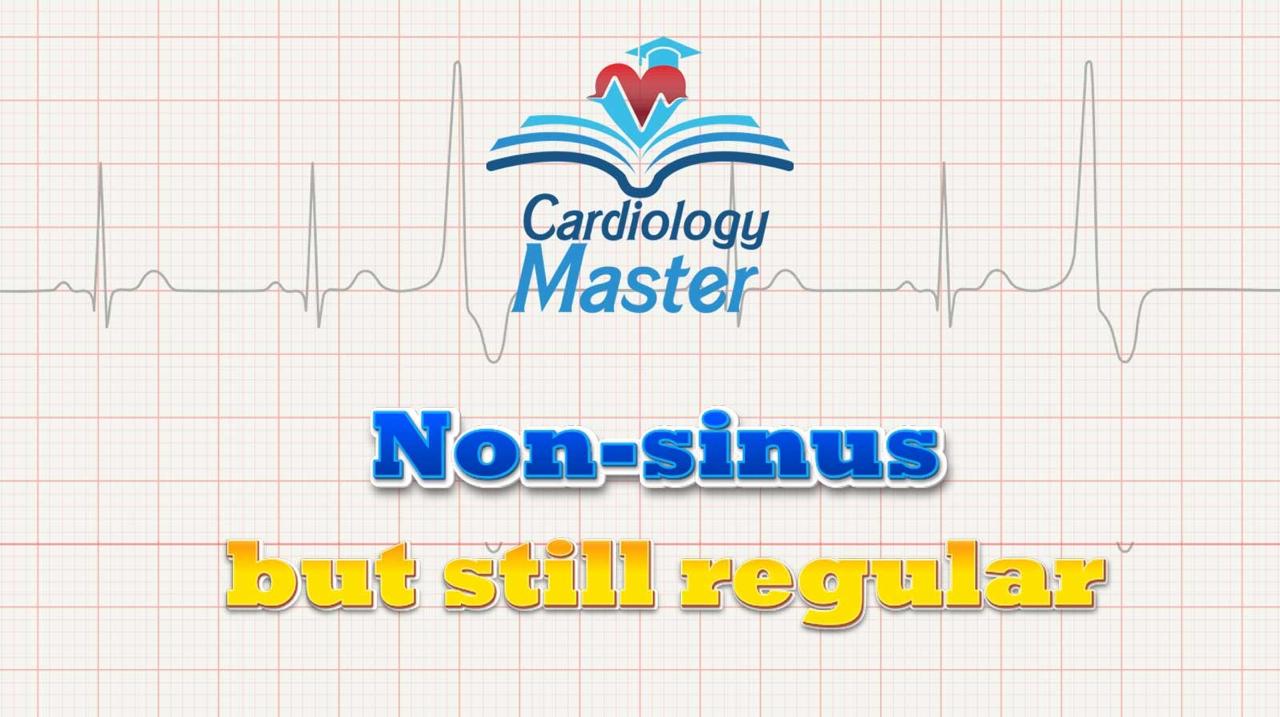 2. Non-sinus but still regular