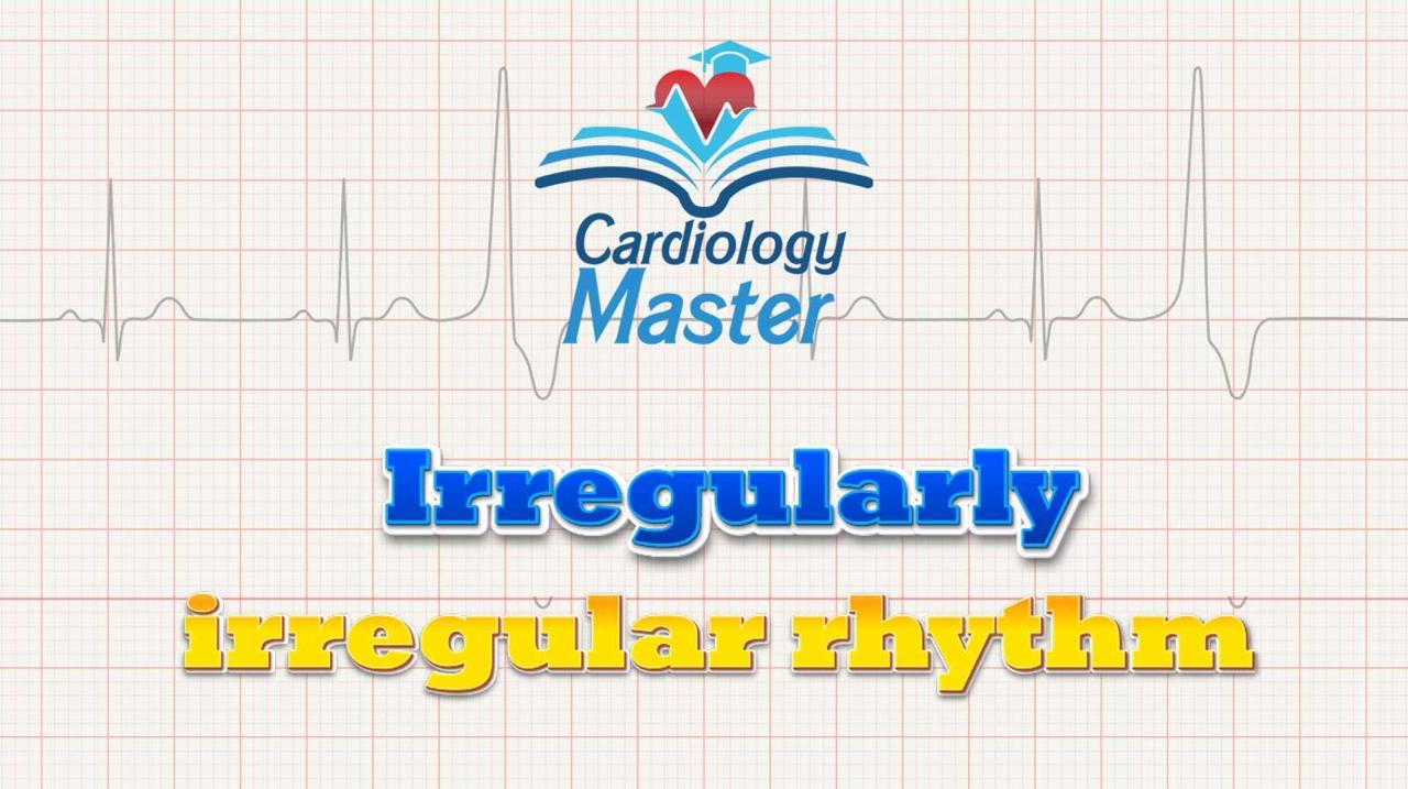 3. Irregularly irregular rhythm