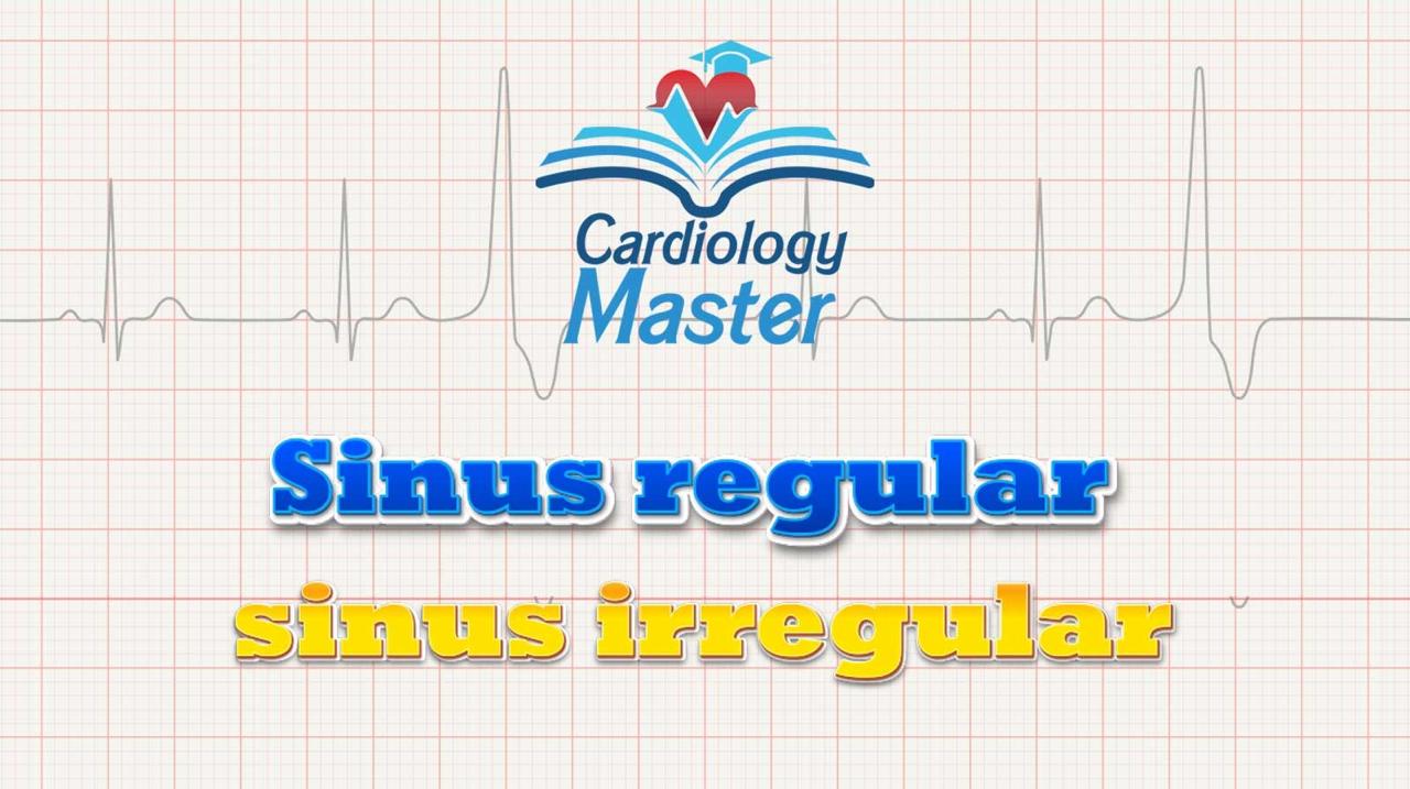Sinus regular, sinus irregular
