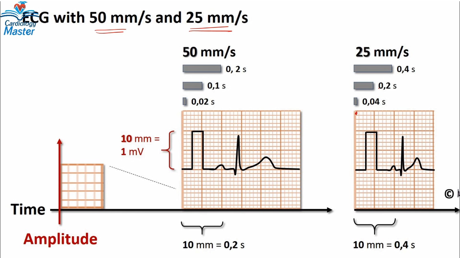 ECG Basics